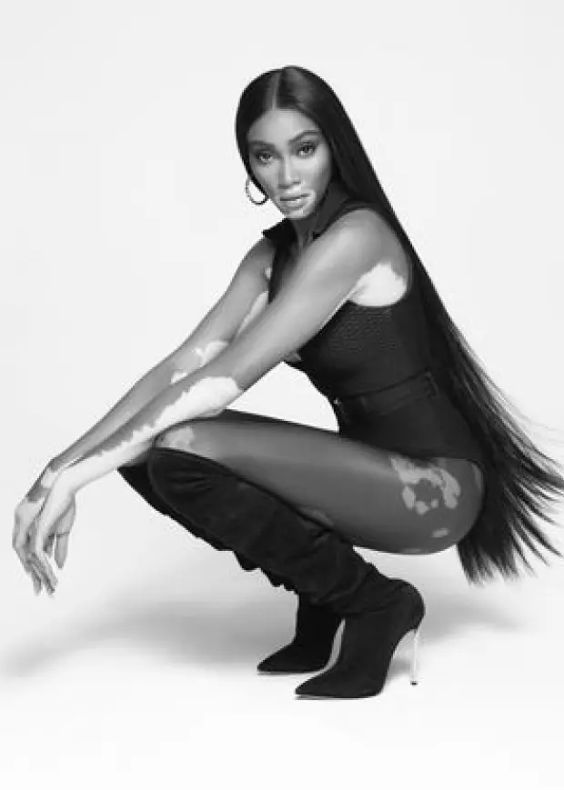 CASADEI – Winnie Harlow